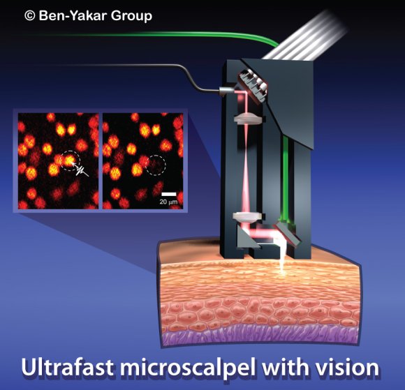 Ultrafast microscalpel with a vision.