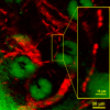 Check out my blood!  <i>Ex vivo</i> stimulated emission image of microcapillaries of a mouse ear based on endogenous hemoglobin contrast (in red color), showing individual blood cells in the vessel network (inset) surrounding sebaceous glands (green overlay based on confocal reflectance).